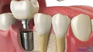 5 تکنیک چینی‌ها برای سلامت دندان‌ها