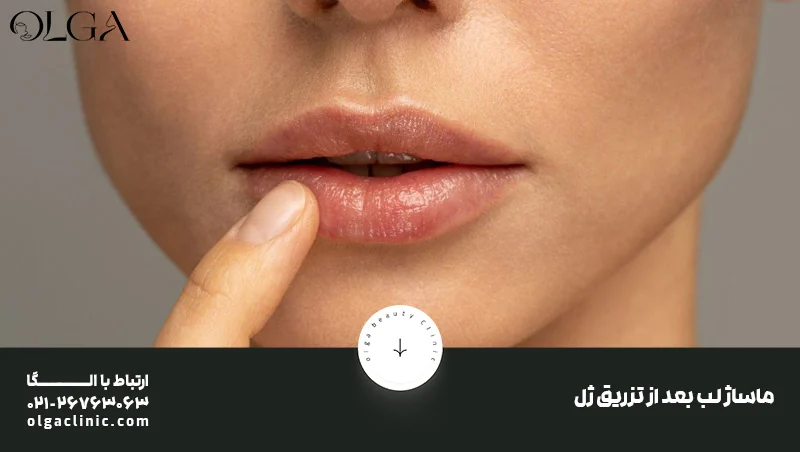 ماساژ لب بعد از تزریق ژل چه تاثیری دارد؟