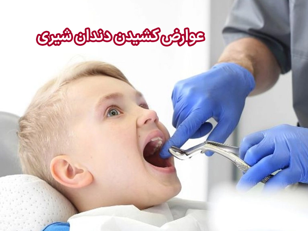 دندانپزشکی | ارتودنسی عوارض کشیدن دندان شیری کودکان